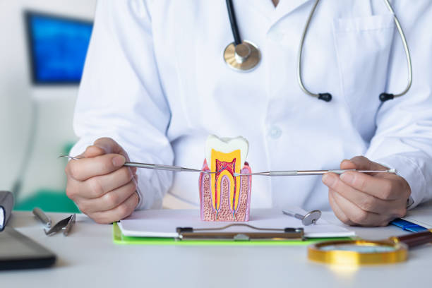Best Knocked-Out Tooth (Avulsed Tooth) Treatment in Fayette, AL